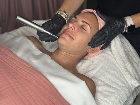 Micro needling added on to an anti-aging facial