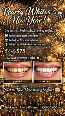 New Year - Brighter Smile