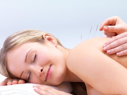 Acupuncture available!