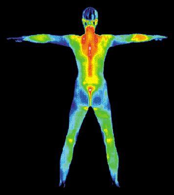 Thermography