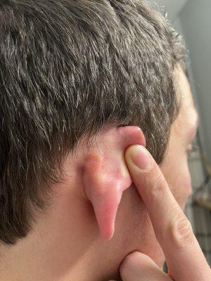 Missed sections around the ear