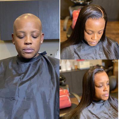 Dealing with hair loss let me help you with a medical cranial prosthesis