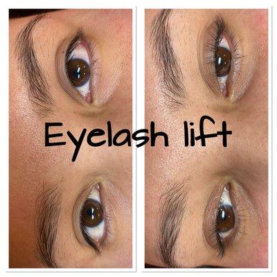 Eyelash lift