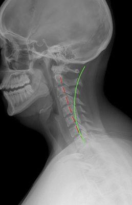 Optimal Spine and Body LLC