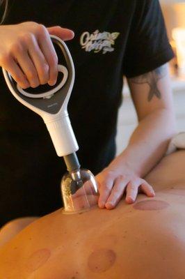 Cupping Therapy for tough knots and chronic tension.