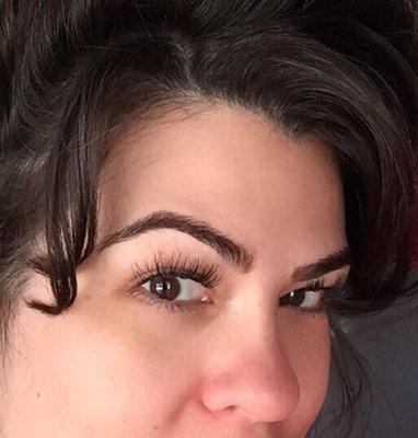 I wish I would've taken a "before" photo. This is the day after. No scabs, no swelling, no redness! Healing perfectly.