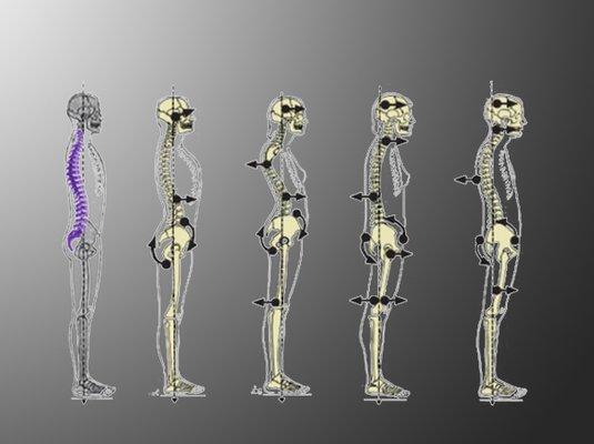 How is your posture?