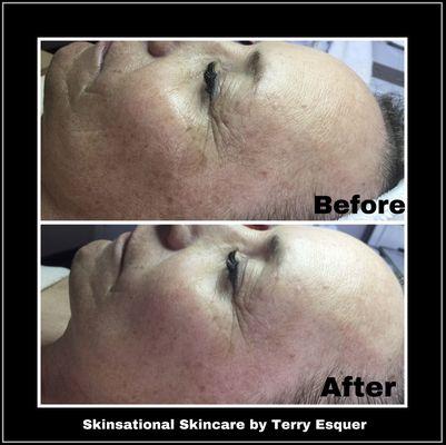 Skinsational Skincare