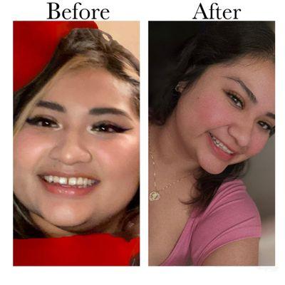 Pacific Dental Smiles