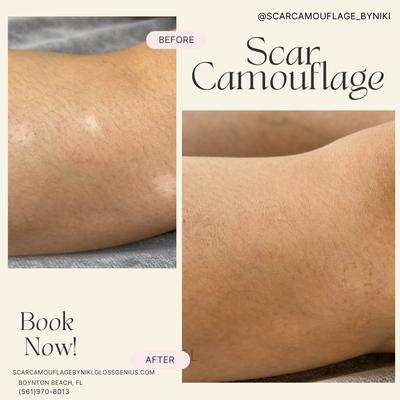 Scar Camouflage By Niki