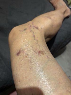 Vein & Vascular Center of South Florida