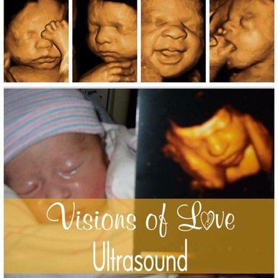 Visions Of Love Ultrasound