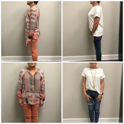 Inspire Weight Loss - Orlando