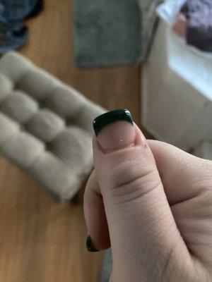 The thumbs were the worst