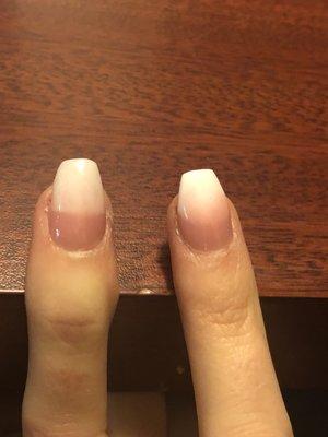 Right ring finger compared to left..