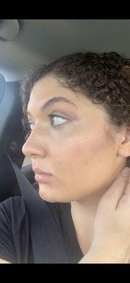 Orangey. Zero coverage.