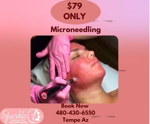 Sparkle Laser Hair/tattoo removal & skin