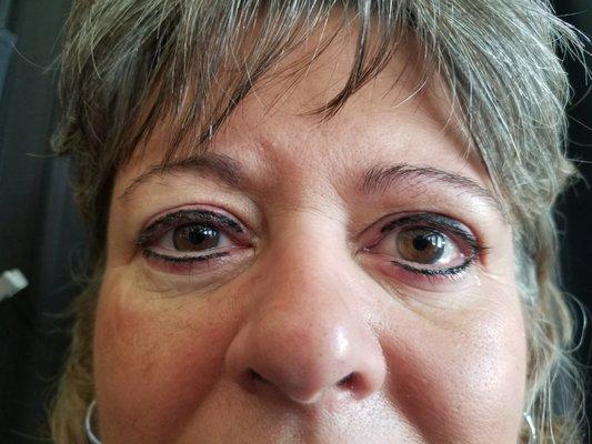 Eyeliner top & bottom directly after procedure.