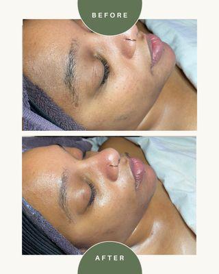 Moment Aesthetics & Wellness