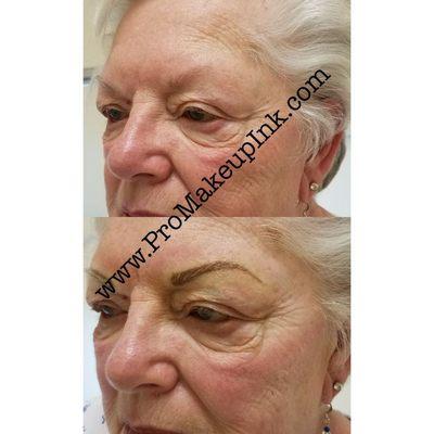 Client had lost most eyebrow and desired a fuller brow look before and after immediately taken