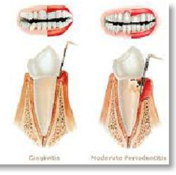 Periodontist Rockville, MD