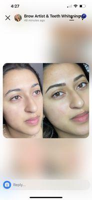 Before and after 1st session