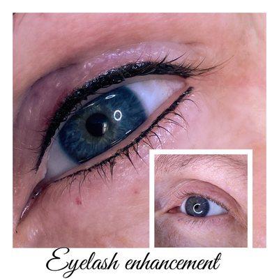 Eyelash enhancement