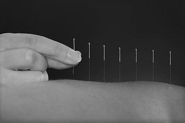 Crawford Acupuncture