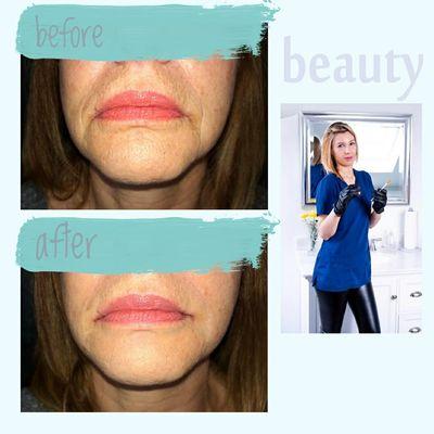 Metrowest Aesthetics