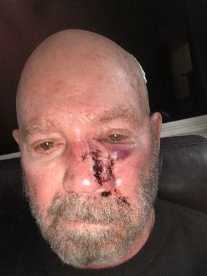 Dustin Heringer, MD-Arizona Ocular & Facial Plastic Surgery