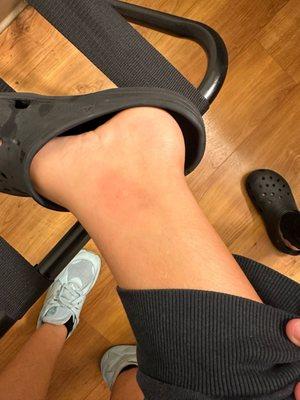 Como amaneció mis hijos de anoche en la habitación 252 lleno de chinches esto no quiero que le pase a otra familia