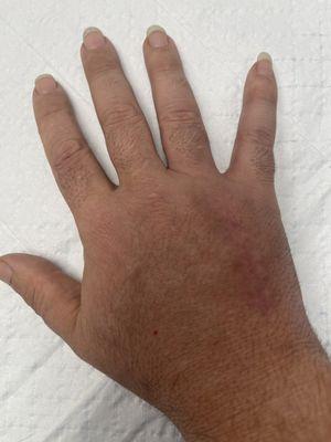 Jenniefer Kho - Valley Hand & Orthopaedics