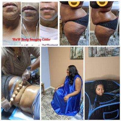 Just a few services that
 We Are Winning offer double chin treatments, wood therapy, foot detox treatments and more