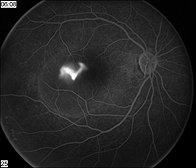 Mid Atlantic Retina