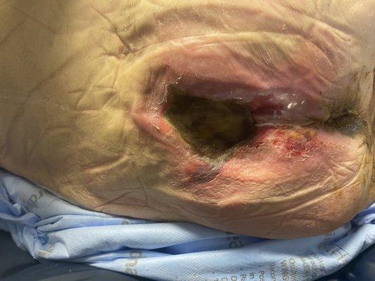 Riverview Care Center