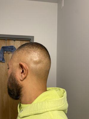 Beard faded in and high bald fade by Cesar.