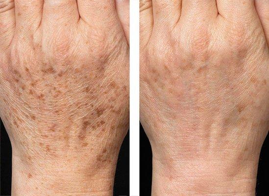 Real Results Skin Care Therapy