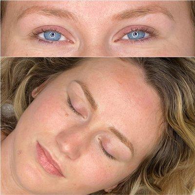Microblading