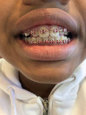 Baum Orthodontics