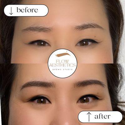 Before and after combo brow results