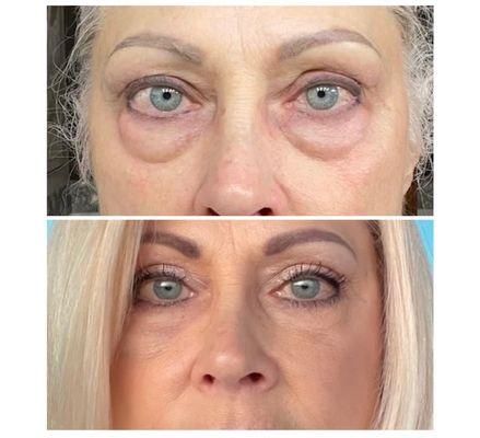 Blackledge Face Center