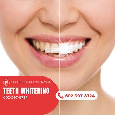 Touch Of Elegance N Valley