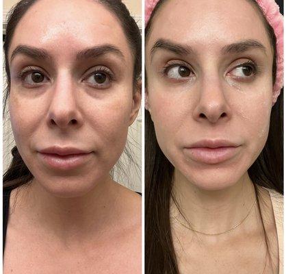 Sameer Bashey, MD FAAD