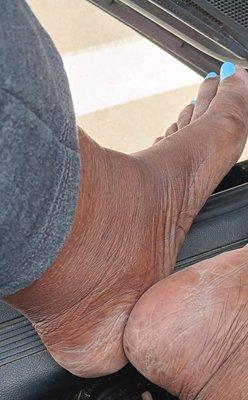 my feet after the pedicure