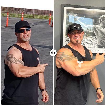 Gameday Men's Health Arcadia TRT, Weight Loss, ED Clinic