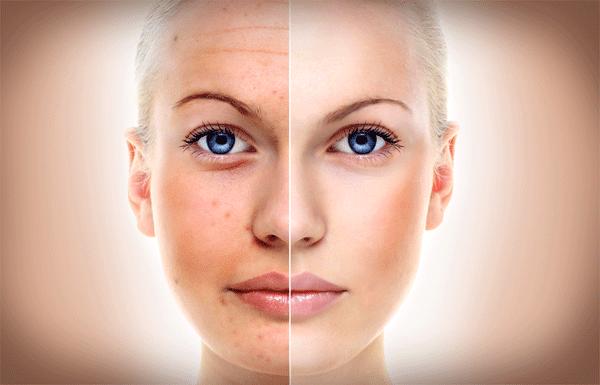 Anti-Aging Collagen Rejuvenation