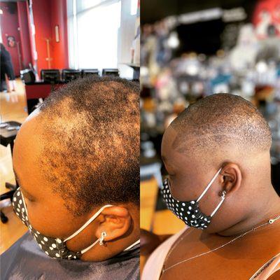 I remember doing this cut and on her Birthday, and she cried, and was so thankful that she could actually go out and not feel self conscious