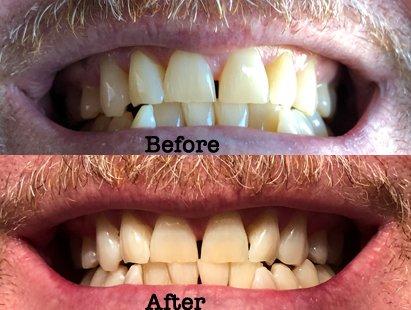 Annette Van Natta, DDS