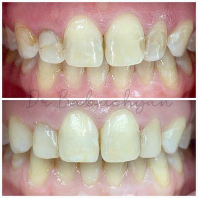 Valentina Babuchyan, DDS - Valley Dental Spa