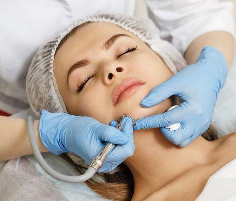 Microdermabrasion